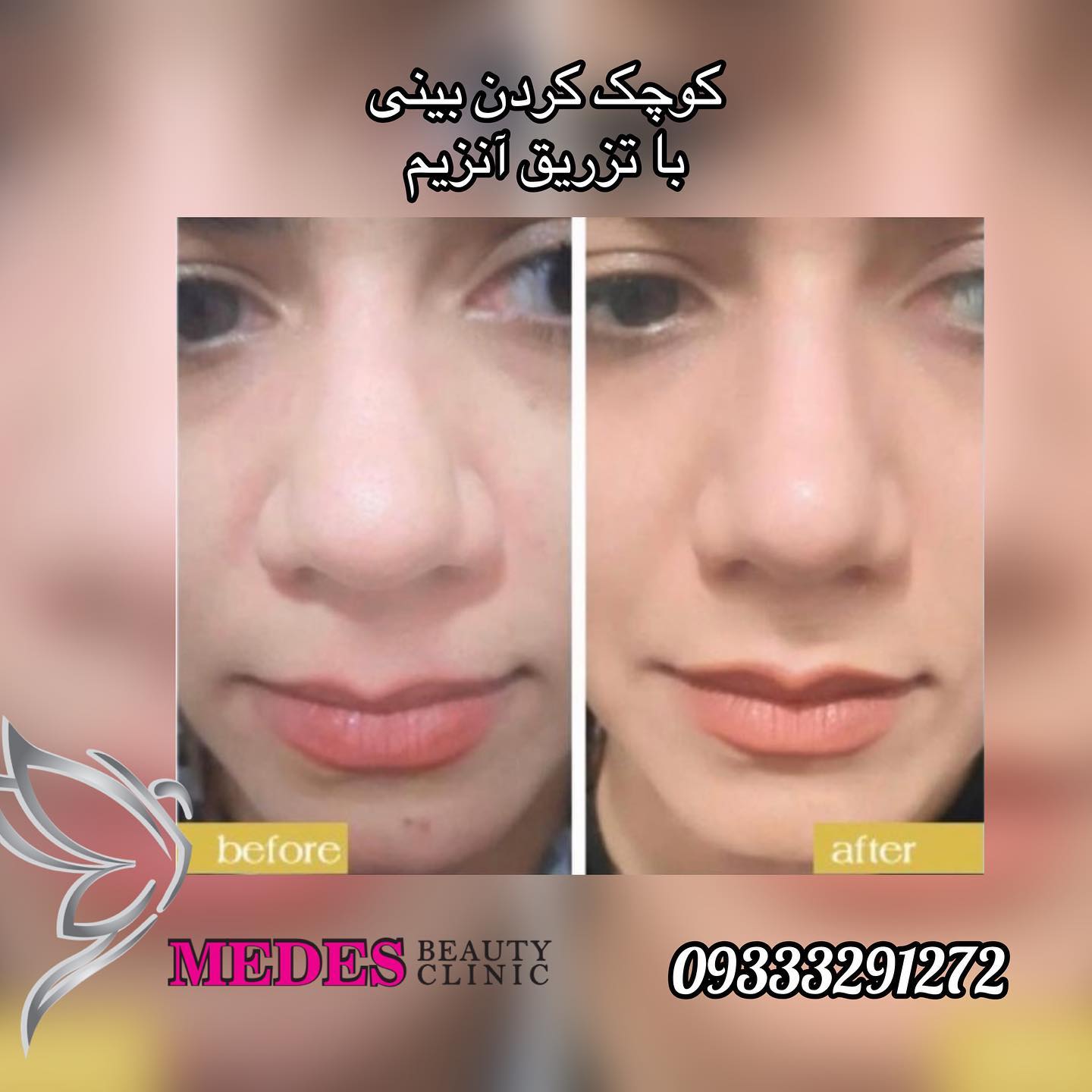 گالری اصلاح فرم بینی